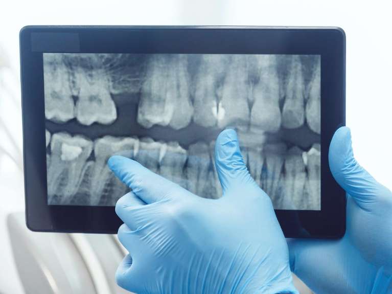 Digital X-Rays and Sensors in Pampa TX